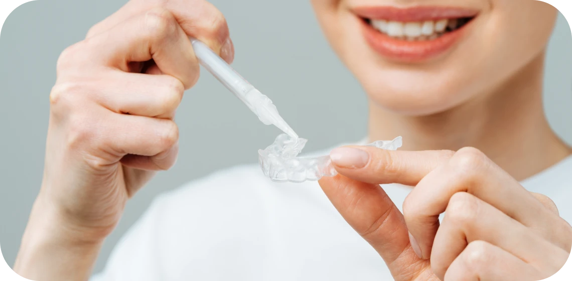 blanchiment-dentaire-tarare-centre-implantologie-teintureries