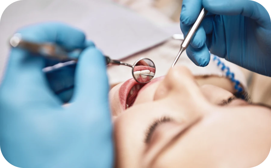 extraction dentaire centre teintureries tarare Extraction dentaire Centre d’implantologie des Teintureries