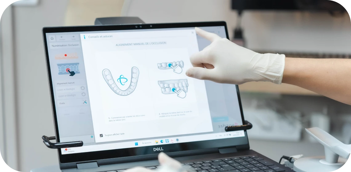 occlusodontie-tarare-centre-implantologie-teintureries