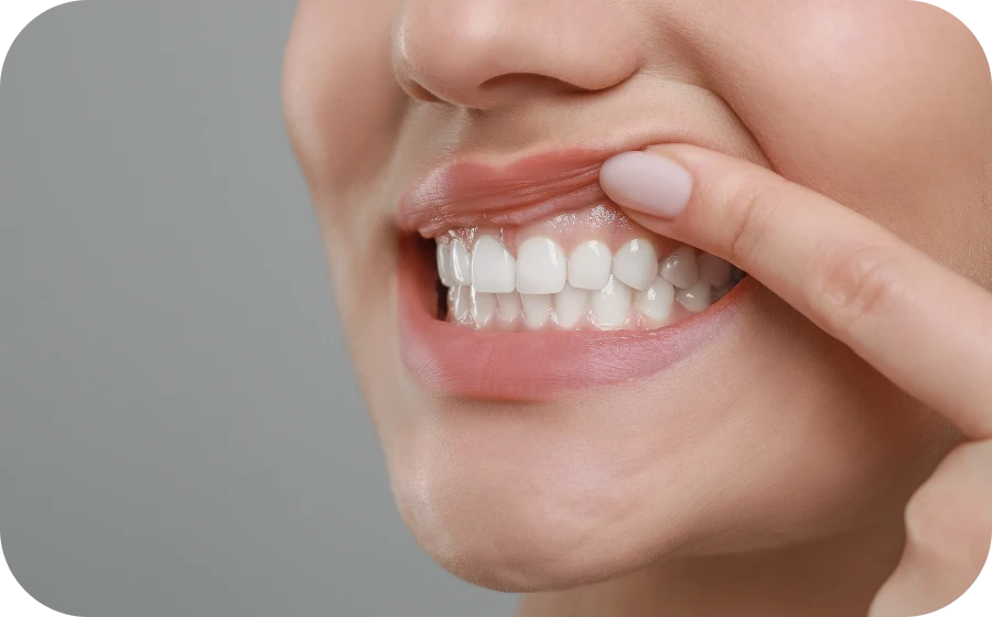 parodontologie clinique dentistes tarare Parodontologie clinique Centre d’implantologie des Teintureries