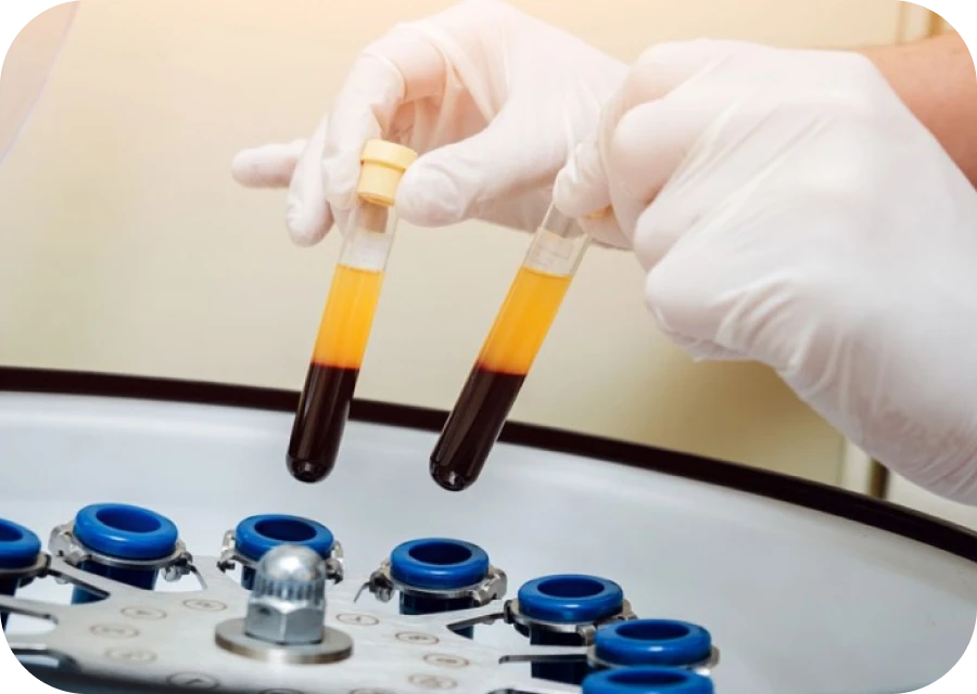 prf centre implantologie teintureries tarare Technologies Centre d’implantologie des Teintureries