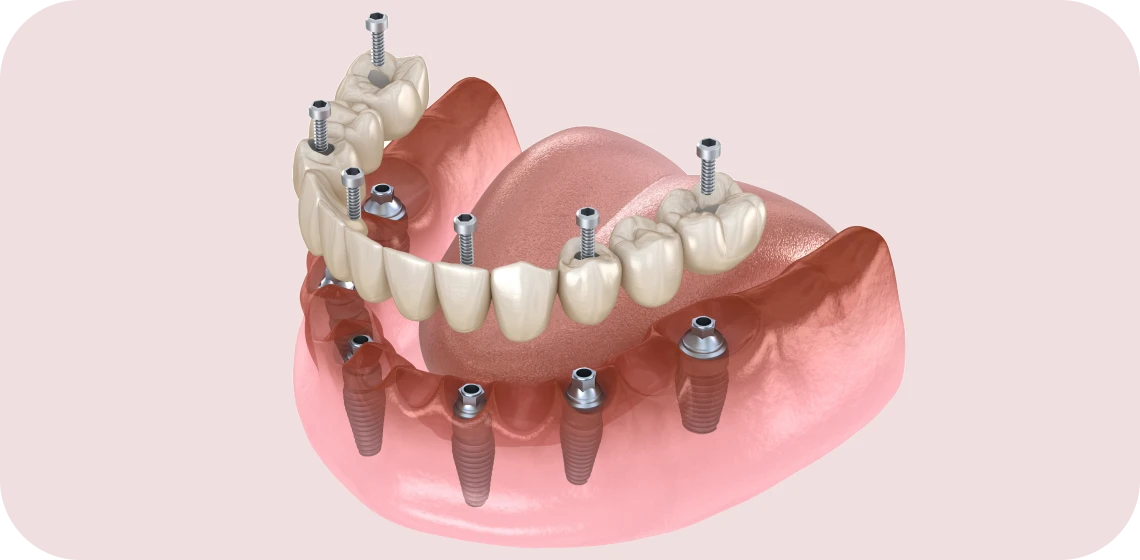rehabilitation-complete-dr-poulet-tarare