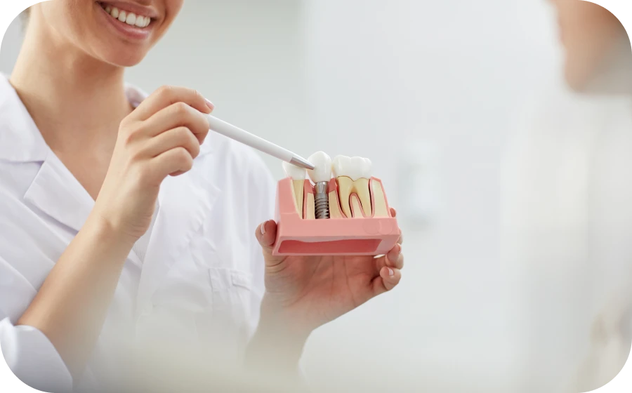 implant dentaire villefranche sur saone Implant dentaire à Villefranche-sur-Saône Centre d’implantologie des Teintureries